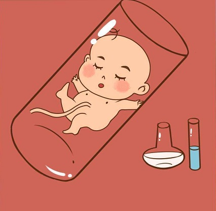 反复流产